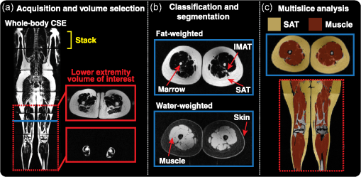 JMI_10_3_036001_f004.png